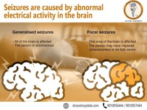 Surgical management of Epilepsy