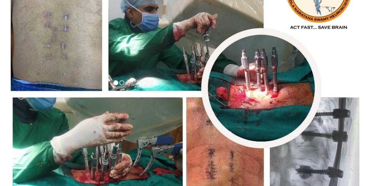 minimally-invasive-spine-surgery-all-you-need-to-know