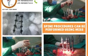 Spine-Surgery