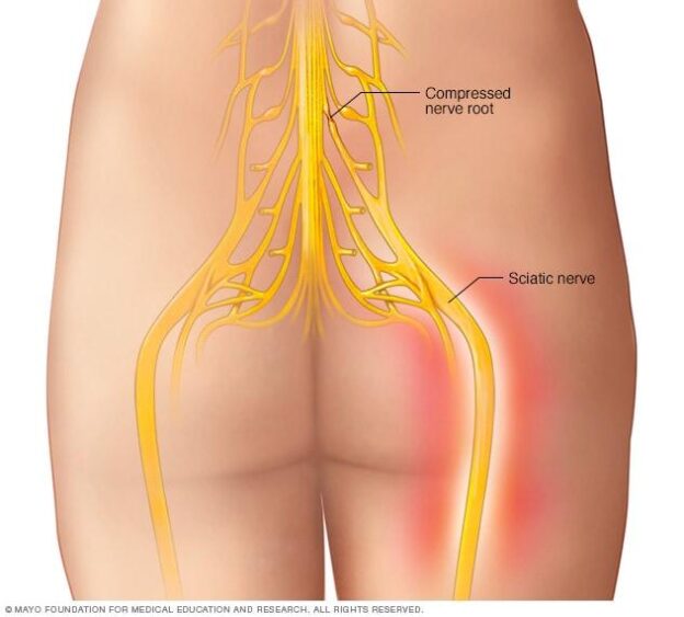 the-best-sciatica-treatment-in-Guntur at Dr Rao's Hospital by Dr Rao