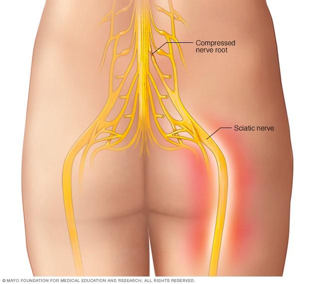 the-best-sciatica-treatment-in-Guntur at Dr Rao's Hospital by Dr Rao