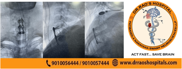 the-best-spinal-surgery-treatment-dr-raos-hospital-guntur