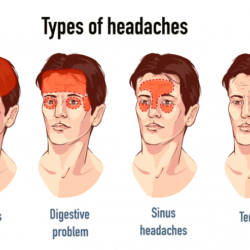 the-best-tension-headache-treatment-is-at-dr-raos-hospital