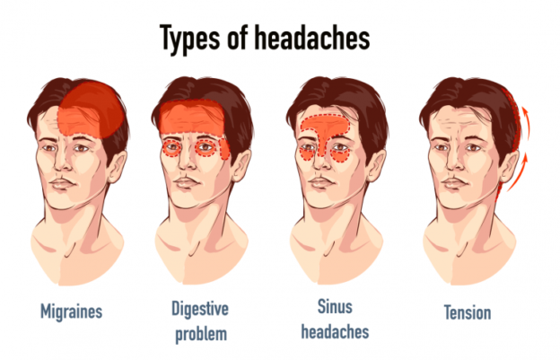 The best Tension headache treatment is at Dr Raos hospital - Dr Rao's ...