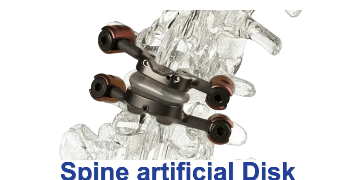 artificial-disc-the-best-at-dr-raos-guntur