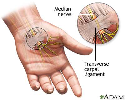 carpal-tunnel-syndrome-the-best-treatment-at-dr-raos-guntur