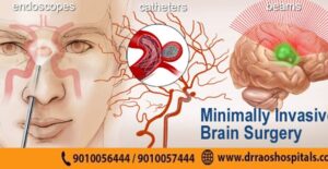 Image of a minimally invasive brain surgery procedure, showcasing small incisions and precise medical tools, ensuring quicker recovery