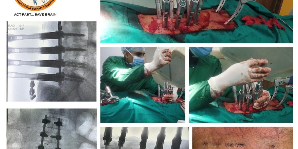 Dr. Rao performing minimally invasive spine surgery at Dr. Rao’s Hospital, showing intra-op X-rays, post-op images, and surgical incisions