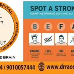 Recognize stroke signs early for timely care at Dr. Rao’s Hospital: speech slurring, sudden weakness, facial drooping. Act fast for treatment!