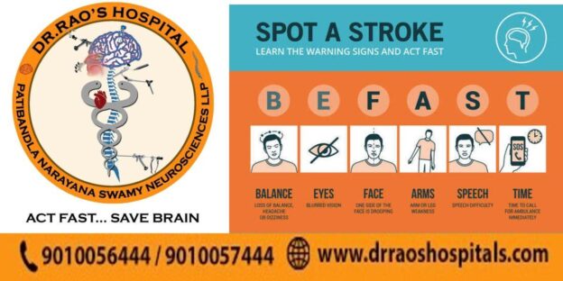 Recognize stroke signs early for timely care at Dr. Rao’s Hospital: speech slurring, sudden weakness, facial drooping. Act fast for treatment!