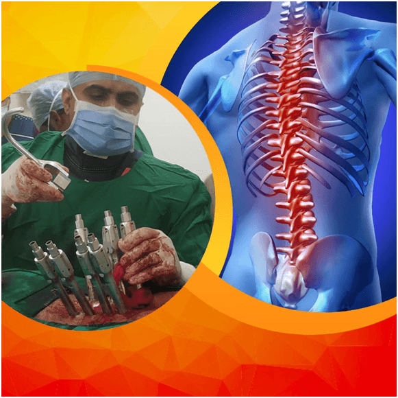 Why Choose Minimally Invasive Spine Surgery (MIS)? A Comprehensive Guide