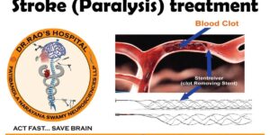 Minimally Invasive Approaches for Treating Brain Tumors: Advancements at Dr. Rao’s Hospital