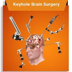 The best Minimally Invasive Keyhole Endoscopic Spine Surgery in Guntur