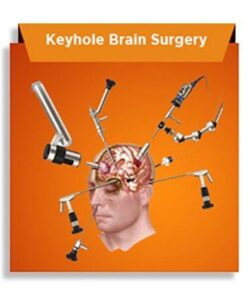 The best Minimally Invasive Keyhole Endoscopic Spine Surgery in Guntur