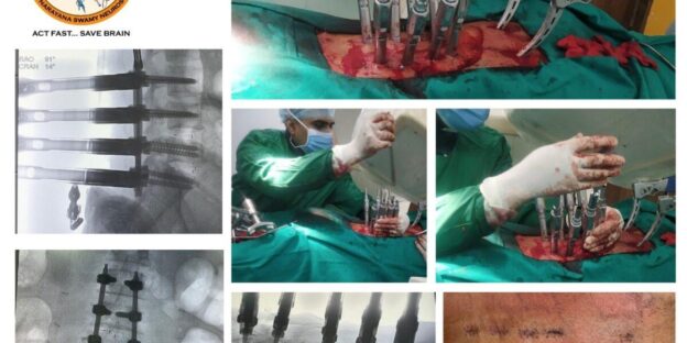 Factors Influencing Selection of Biologic Strategies for Successful Surgical Fusion