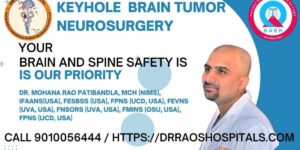 20 FAQs about brain tumors by Dr. Rao’s Expert opinion