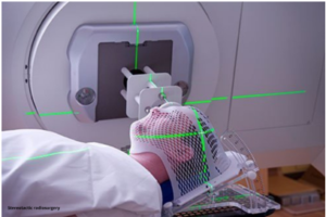 Stereotactic radiosurgery at Dr Rao's Hospital by Dr Rao