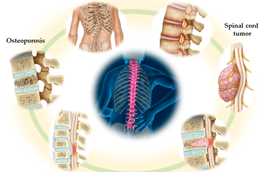 Neurosurgery in the Elderly: Addressing Unique Challenges and Optimizing Outcomes