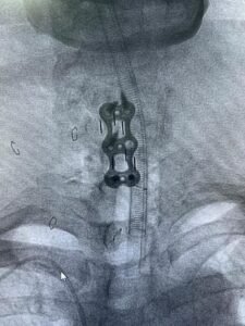 Prioritizing Patient Safety: Measures Taken at Spine Surgery Hospitals - Dr. Rao at Dr. Rao's Hospital