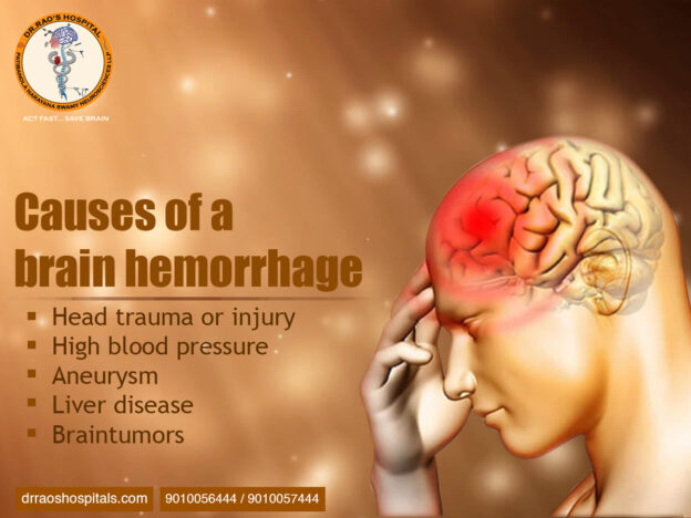Brain Hemorrhage: Comprehensive Care at Dr. Rao's Hospital