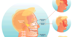 The best Neurosurgery for Trigeminal Pain at Dr Rao’s