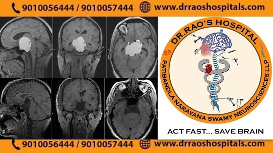 Pre and post-op MRI scans of craniopharyngioma patient, showing successful surgery by Dr. Rao at Dr. Rao's Hospital.